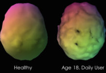 Study Finds Marijuana Increases Risk of Dementia and Alzheimer’s